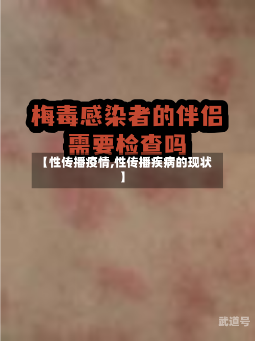 【性传播疫情,性传播疾病的现状】
